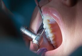 Imagen de Endodoncia